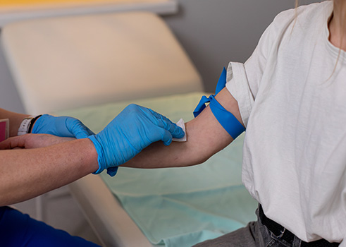 HIV-1筛查及诊断