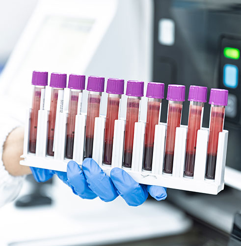 微量精准耐药突变检测